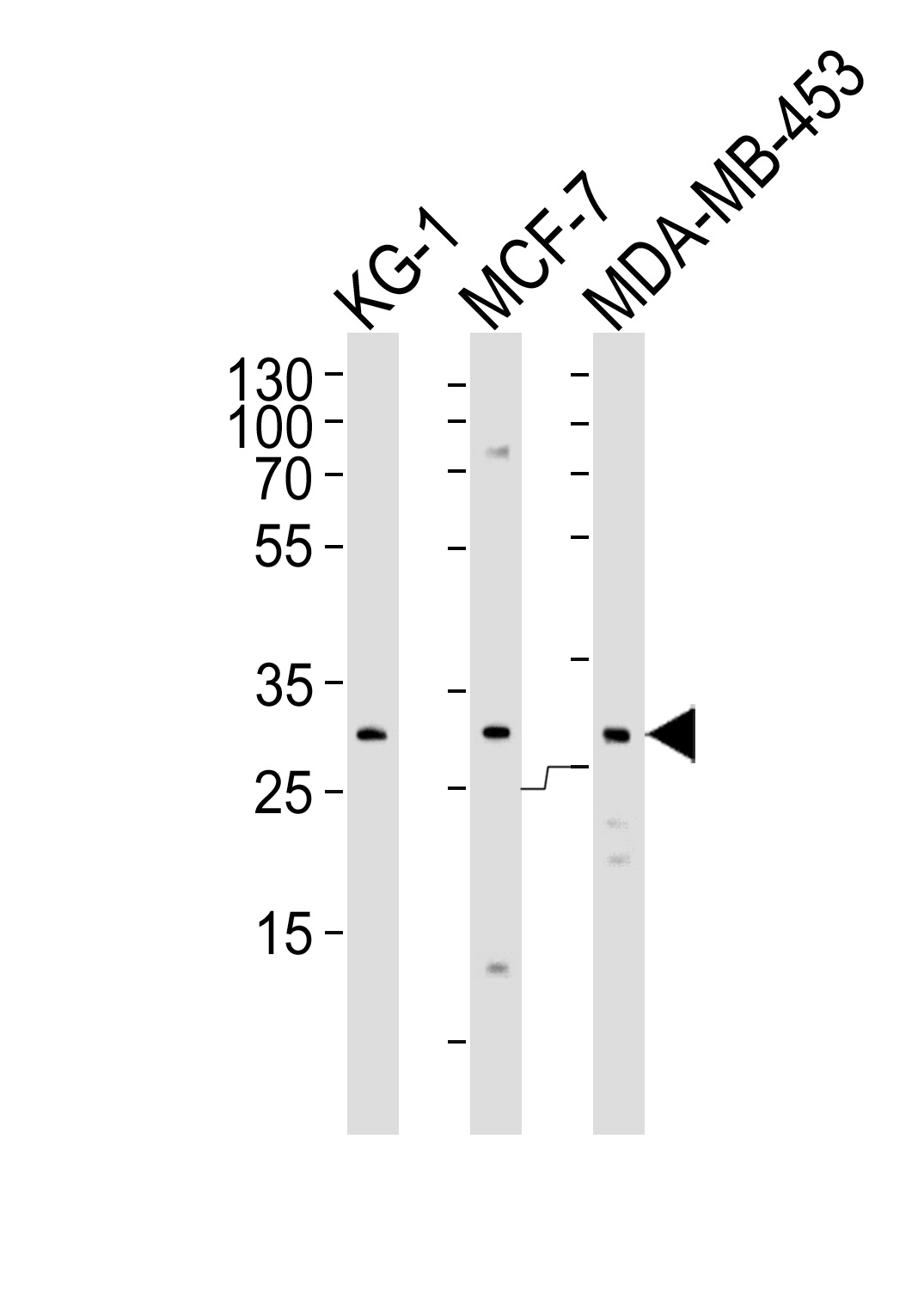 FOLR2 Antibody