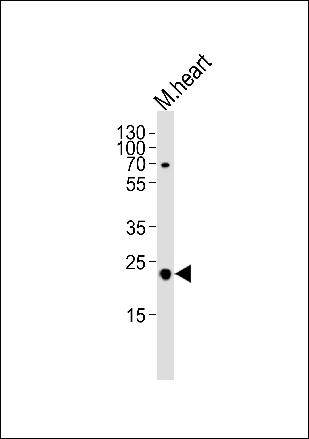 FOLR2 Antibody