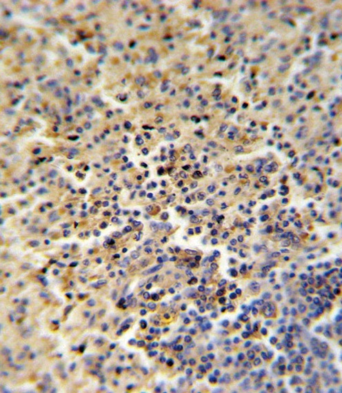 FOLR2 Antibody