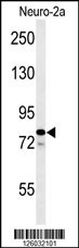 FAM91A1 Antibody
