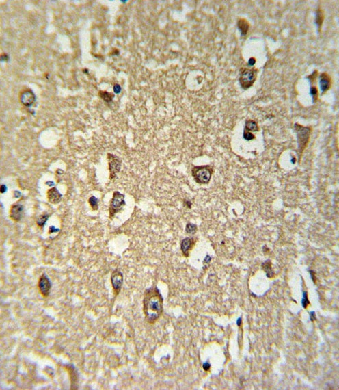 CHRNA3 Antibody