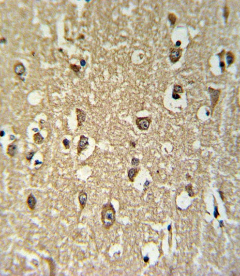 CHRNA3 Antibody