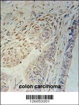 CCDC92 Antibody