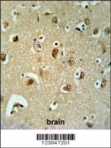 B3GALT6 Antibody