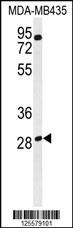 RRAGD Antibody