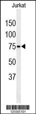 PAN3 Antibody