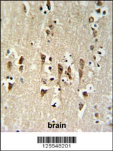 KCTD1 Antibody