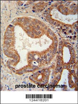 CSGALNACT1 Antibody