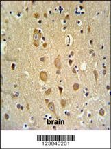 APITD1 Antibody