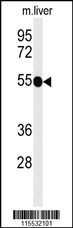 TNFRSF8 Antibody