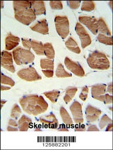 ATP2A1 Antibody