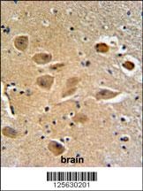 MICALL2 Antibody