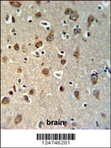 YME1L1 Antibody