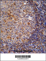 ARHGAP25 Antibody