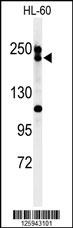 BLM Antibody