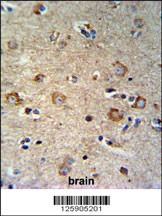 SETD6 Antibody