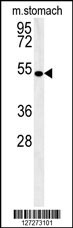 CORO6 Antibody