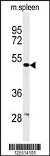 CORO6 Antibody
