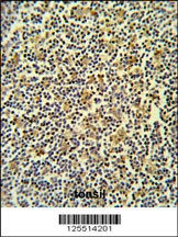 CORO6 Antibody