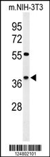 KLDC2 Antibody