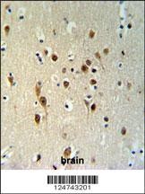 TOX3 Antibody