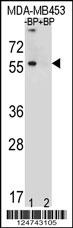 TOX3 Antibody