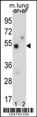 TOX3 Antibody