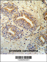 CWC15 Antibody