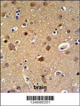 TELO2 Antibody