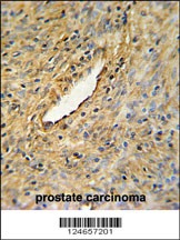 CEP63 Antibody