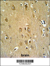 SYTL2 Antibody