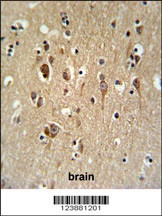 FA2H Antibody