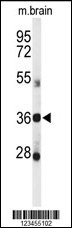 DDO Antibody