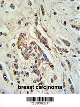 ABCC11 Antibody