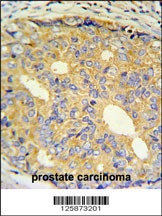 ZNF9 Antibody
