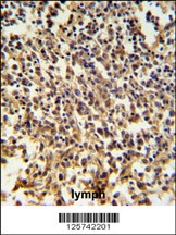 RNASEH2B Antibody