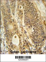 AVIL Antibody