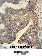 PAR6G Antibody