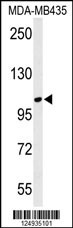 LUZP1 Antibody