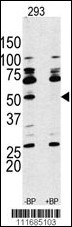 RPS6KB1 Antibody