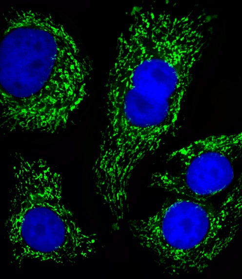 ATP5B Antibody