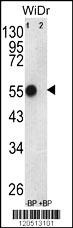 ATP5B Antibody