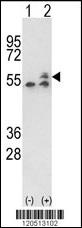 ATP5B Antibody