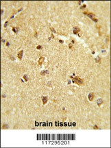 RBM14 Antibody