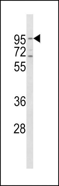 TFRC Antibody