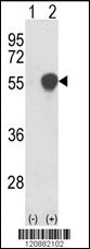 PHGDH Antibody