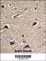 PGLS Antibody