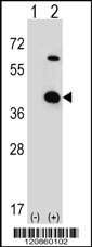 STRAP Antibody