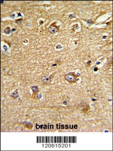 IMMT Antibody