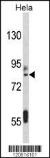 IMMT Antibody